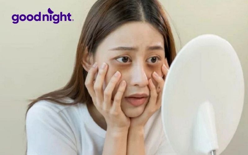 Ngủ muộn, thiếu ngủ là nguyên nhân hàng đầu gây thâm mắt